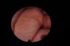 OPTIM ENTity XL Endoscope