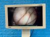 FUJINON EG-580NW Gastroscope