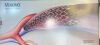 BARD VENUL18060 VENOVO Venous Stent 18 X 60mm