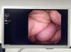 OLYMPUS Scope Model: CYF-VA Endoscopy Processor