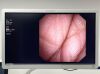 OLYMPUS Scope Model: CYF-VA Endoscopy Processor