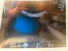 GE C2-9-D Ultrasound Transducer