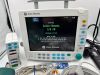 GE GENERAL ELECTRIC DATEX FM MONITOR N-FREC-00 E-PSMP-00 MODULE F-FM-00 Monitor