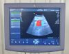 GE Voluson P8 Ultrasound System 5484707 W/  4C-RS Convex Array Transducer - 199191 Voluson P8