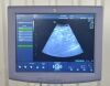 GE Voluson P8 Ultrasound System 5484707 W/  4C-RS Convex Array Transducer - 199191 Voluson P8