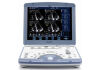 GE Vivid I Ultrasound Machine