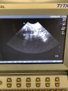 SONOSITE C11 Ultrasound Transducer
