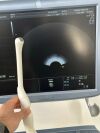 GE Voluson E6 Ultrasound - OB / GYN