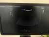 SAMSUNG HS40 Ultrasound - OB / GYN