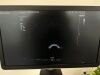 SAMSUNG HS40 Ultrasound - OB / GYN