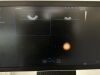 SAMSUNG HS60 Ultrasound - OB / GYN