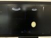 SAMSUNG HS60 Ultrasound - OB / GYN