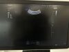 SAMSUNG HS60 Ultrasound - OB / GYN