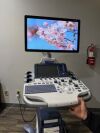 GE Ultrasound LOGIQ S8 GE LOGIQ S8 XDClear