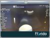 GE 2007 RAB2-5-D IPX7 CURVED ARRAY TRANSDUCER PROBE REF H48651MN  FOR PARTS OR REPAIR Ultrasound Transducer