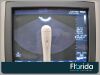 PHILIPS 3D9-3V ENDOCAVITARY TRANSDUCER PROBE REF 453561222119 TESTED 30 DAYS WARRANTY Ultrasound Transducer