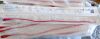 BARD 277710 All-Purpose Urethral Catheter 10Fr , X-Ray Opaque Rubber w/ Funnel End (#A4) (LOT/24) 2028/03/31