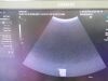 SIEMENS Acuson S2000 HELX Evolutio Ultrasound - Shared Service