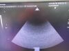 SIEMENS Acuson S2000 HELX Evolutio Ultrasound - Shared Service