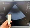 GE 3S Cardiac Ultrasound Transducer