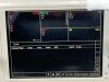 PHILIPS 863073 Monitor