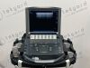 SONOSITE M-Turbo PORTABLE ULTRASOUND W/ PROBE   PRINTER 2013