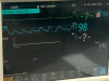 PHILIPS M3001A Module
