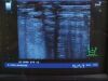 ALOKA UST-5712 Ultrasound Transducer