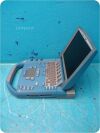 SONOSITE Micromaxx P088420 ULTRASOUND SYSTEM