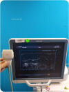 TOSHIBA PLT-704AT Ultrasound Transducer