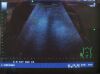 ALOKA UST-9126 Ultrasound Transducer