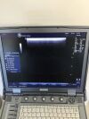 GE Logiq E Ultrasound - Cardiac - Vascular