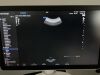SAMSUNG HERA W10 Ultrasound - OB / GYN