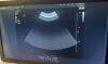 SAMSUNG HS60 Ultrasound - OB / GYN
