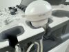SAMSUNG HS60 Ultrasound - OB / GYN