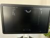SAMSUNG HS60 Ultrasound - OB / GYN
