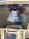 TOSHIBA Aplio 400 Ultrasound System