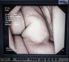 OLYMPUS TJF-Q180V Duodenoscope