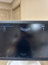 SAMSUNG Hera W10 Ultrasound - OB / GYN - Vascular