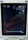GE VSCAN Portable Ultrasound
