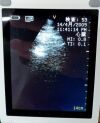 GE VSCAN Portable Ultrasound