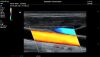 MINDRAY MX7 NEW Mindray MX7 Portable Ultrasound System
