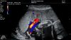 MINDRAY MX7 NEW Mindray MX7 Portable Ultrasound System