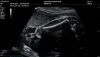 MINDRAY MX7 NEW Mindray MX7 Portable Ultrasound System