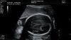 MINDRAY MX7 NEW Mindray MX7 Portable Ultrasound System
