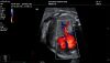 MINDRAY M8 Elite Ultrasound - Cardiac