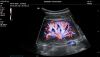 MINDRAY M8 Elite Ultrasound - Cardiac