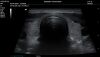 MINDRAY M8 Elite Ultrasound - Cardiac