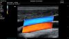 MINDRAY M8 Elite Ultrasound - Cardiac