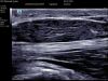 MINDRAY TE5 NEW Mindray TE5 Ultrasound System